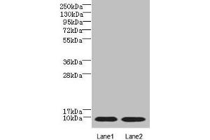 Western blot All lanes: NOP10 antibody at 4 μg/mL Lane 1: Jurkat whole cell lysate Lane 2: Caco-2 whole cell lysate Secondary Goat polyclonal to rabbit IgG at 1/10000 dilution Predicted band size: 8 kDa Observed band size: 8 kDa (rRNA 2'-O-Methyltransferase Fibrillarin (FBL) (AA 1-64) Antikörper)