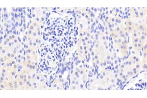 Detection of DHODH in Human Kidney Tissue using Polyclonal Antibody to Dihydroorotate Dehydrogenase (DHODH) (DHODH Antikörper  (AA 35-392))