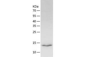Western Blotting (WB) image for C1D Nuclear Receptor Corepressor (C1D) (AA 1-141) protein (His tag) (ABIN7122066)