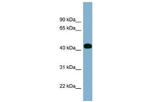 ITPK1 antibody used at 1 ug/ml to detect target protein. (ITPK1 Antikörper  (Middle Region))