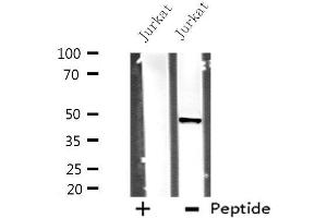 Western blot analysis of extracts from Jurkat cells, using DHODH antibody. (DHODH Antikörper  (Internal Region))