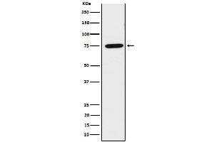 Western blot analysis of LPP expression in HeLa cell lysate.