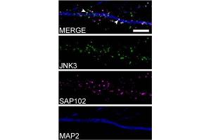 anti-Discs, Large Homolog 3 (DLG3) (AA 1-120) antibody