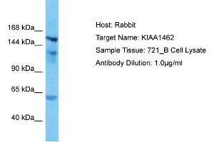 Host: Rabbit Target Name: KIAA1462 Sample Type: 721_B Whole Cell lysates Antibody Dilution: 1. (JCAD/KIAA1462 Antikörper  (N-Term))