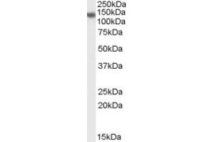 Western Blotting (WB) image for anti-Disabled Homolog 2, Mitogen-Responsive phosphoprotein (Drosophila) (DAB2) (N-Term) antibody (ABIN2156670) (DAB2 Antikörper  (N-Term))