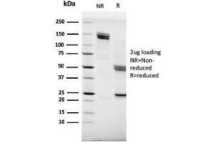 SDS-PAGE (SDS) image for anti-Membrane-Spanning 4-Domains, Subfamily A, Member 1 (MS4A1) (AA 213-297) antibody (ABIN6941105)