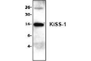 Image no. 1 for anti-KiSS-1 Metastasis-Suppressor (KISS1) (N-Term) antibody (ABIN127218) (KISS1 Antikörper  (N-Term))