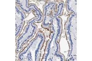Immunohistochemical staining (Formalin-fixed paraffin-embedded sections) of human duodenum with DLC1 polyclonal antibody  shows distinct positivity of microvilli in glandular cells. (DLC1 Antikörper)
