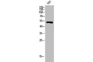 Western Blot analysis of VEC cells using Desmin Polyclonal Antibody (Desmin Antikörper  (C-Term))