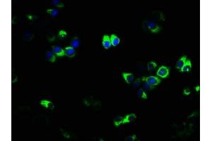 Immunofluorescence staining of PC-3 cells with ABIN7173843 at 1:133, counter-stained with DAPI. (TNFRSF11A Antikörper  (AA 28-202))