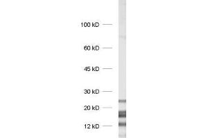 dilution: 1 : 1000, sample: rat brain homogenate (MBP Antikörper)