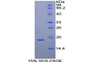 SDS-PAGE analysis of Mouse Neurotensin Protein.