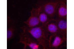 Immunofluorescence staining of methanol-fixed MCF-7 cells using Phospho-ESR1-S118 antibody (ABIN2987431). (Estrogen Receptor alpha Antikörper  (pSer118))