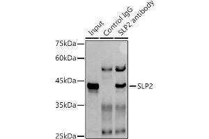 Immunoprecipitation analysis of 300 μg extracts of A-549 cells using 3 μg SLP2 antibody (ABIN7270675). (SYTL2 Antikörper)