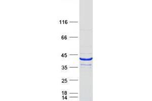 Validation with Western Blot