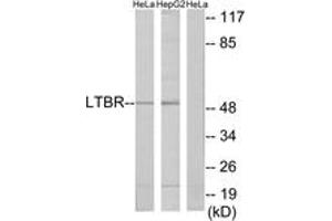 Western blot analysis of extracts from HeLa/HepG2 cells, using LTBR Antibody. (LTBR Antikörper  (AA 11-60))