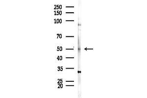 Western blot analysis of lysates from HepG2 cells(LPS,4h treatment), using ZIP7 Antibody at 1/1000 dilution.