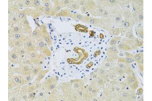 Immunohistochemistry of paraffin-embedded human liver injury using RAB27A Antibody (ABIN5970998) at dilution of 1/100 (40x lens). (RAB27A Antikörper)