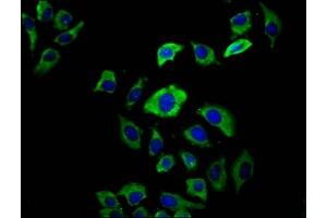 Immunofluorescence staining of A549 cells with ABIN7158397 at 1:66, counter-stained with DAPI. (EVC2 Antikörper  (AA 30-199))