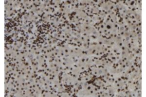 ABIN6273187 at 1/100 staining Human liver tissue by IHC-P. (ZC3HAV1 Antikörper  (Internal Region))