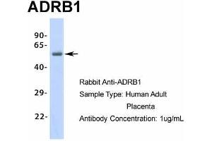 Host: Rabbit Target Name: ADRB1 Sample Type: Human Adult Placenta Antibody Dilution: 1. (ADRB1 Antikörper  (Middle Region))