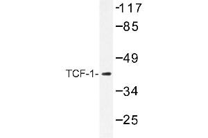 Image no. 1 for anti-HNF1 Homeobox A (HNF1A) antibody (ABIN272184) (HNF1A Antikörper)