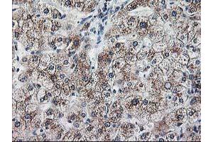 Immunohistochemical staining of paraffin-embedded Human liver tissue using anti-RPN1 mouse monoclonal antibody. (RPN1 Antikörper)