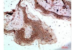 Immunohistochemical analysis of paraffin-embedded human-skin, antibody was diluted at 1:200 (TPSD1 Antikörper  (AA 51-100))