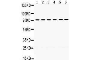 Western Blotting (WB) image for anti-LIM Domain Kinase 2 (LIMK2) (AA 596-635), (C-Term) antibody (ABIN3043412)