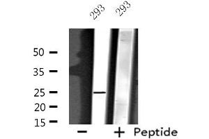 Western blot analysis of extracts from 293 cells, using NDFIP1 antibody.