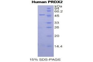 SDS-PAGE (SDS) image for Peroxiredoxin 2 (PRDX2) (AA 6-164) protein (His tag,GST tag) (ABIN1877330)