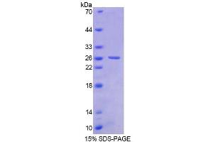 SDS-PAGE (SDS) image for Basonuclin 1 (BNC1) (AA 43-246) protein (His tag) (ABIN6238748) (Basonuclin 1 Protein (BNC1) (AA 43-246) (His tag))