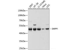 Western blot analysis of extracts of various cell lines using INPP1 Polyclonal Antibody at dilution of 1:1000. (INPP1 Antikörper)
