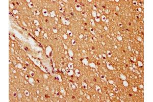 IHC image of ABIN7173447 diluted at 1:200 and staining in paraffin-embedded human brain tissue performed on a Leica BondTM system. (TRIM45 Antikörper  (AA 428-573))