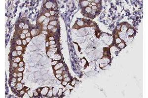 ABIN6269120 at 1/100 staining human colon tissue sections by IHC-P. (c-MET Antikörper  (Internal Region))
