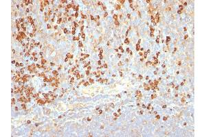 Formalin-fixed, paraffin-embedded human Tonsil stained with Plasma Cell Marker Monoclonal Antibody (LIV3G11). (Plasma Cell Marker Antikörper)