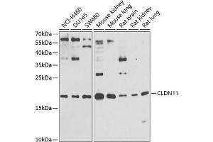 Western blot analysis of extracts of various cell lines, using CLDN11 antibody (ABIN6133643, ABIN6138675, ABIN6138676 and ABIN6216120) at 1:1000 dilution. (Claudin 11 Antikörper  (AA 1-100))