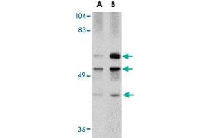 Western blot analysis of GALNT10 in rat brain tissue lysate with GALNT10 polyclonal antibody  at (A) 1 and (B) 2 ug/mL . (GALNT10 Antikörper  (N-Term))