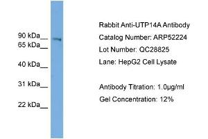 WB Suggested Anti-UTP14A  Antibody Titration: 0. (UTP14A Antikörper  (N-Term))