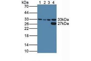 Western blot analysis of (1) Human HeLa cells, (2) Human HepG2 Cells, (3) Human K562 Cells and (4) Porcine Liver Tissue. (CDK2 Antikörper  (AA 94-198))