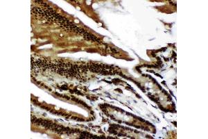 anti-Tumor Protein P73 (TP73) (AA 1-198) antibody