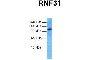 Host:  Rabbit  Target Name:  RNF31  Sample Tissue:  Human MCF7  Antibody Dilution:  1. (RNF31 Antikörper  (Middle Region))