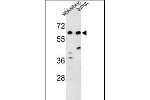 Western blot analysis of C19orf26 Antibody (Center) (ABIN653222 and ABIN2842757) in MDA-M, Jurkat cell line lysates (35 μg/lane). (C19orf26 Antikörper  (AA 423-450))