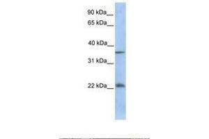 Image no. 1 for anti-RING1 and YY1 Binding Protein (RYBP) (C-Term) antibody (ABIN6737863) (RYBP Antikörper  (C-Term))