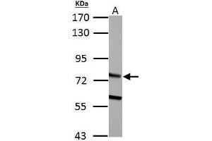 WB Image HADHA antibody detects HADHA protein by Western blot analysis. (HADHA Antikörper  (C-Term))