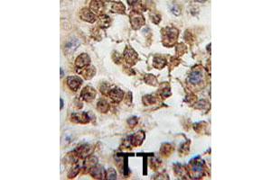 Formalin-fixed and paraffin-embedded human testis tissue reacted with NANOG polyclonal antibody  , which was peroxidase-conjugated to the secondary antibody, followed by DAB staining. (Nanog Antikörper  (Internal Region))