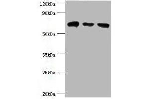 Western blot All lanes: HSPA2 antibody at 6 μg/mL Lane 1: A431 whole cell lysate Lane 2: Hela whole cell lysate Lane 3: Rat brain tissue Secondary Goat polyclonal to rabbit IgG at 1/10000 dilution Predicted band size: 70 kDa Observed band size: 70 kDa (HSPA2 Antikörper  (AA 400-639))