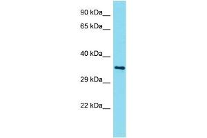 Host: Rabbit Target Name: AMMECR1L Sample Type: NCI-H226 Whole Cell lysates Antibody Dilution: 1. (AMMECR1-Like Antikörper  (N-Term))