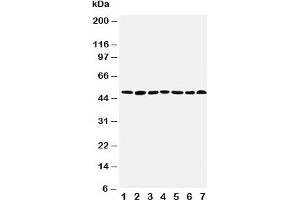 Western blot testing of CtBP1 antibody and Lane 1:  rat brain;  2: rat testis;  3: rat ovary;  4: U87;  5: SW620;  6: HT1080;  7: COLO320 cell lysate