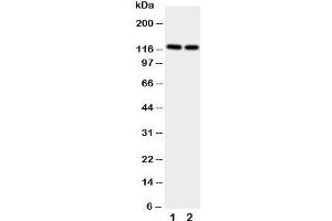 Western blot testing of NRP2 antibody and Lane 1:  rat brain;  2: rat testis.